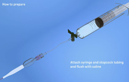 Aspiration Catheter 3D Animation
